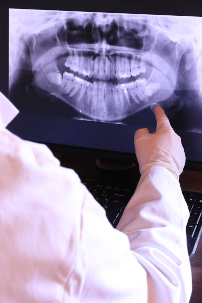Best Knocked-Out Tooth (Avulsed Tooth) Treatment in Kimberling City, MO